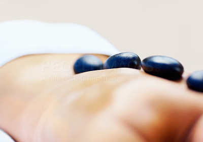 Therapy - Arrangement of hot stones placed on a woman\'s back