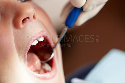 Young child getting his dental treatment done