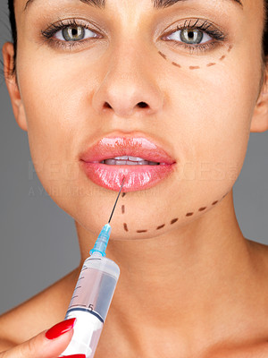 Plastic surgery concept - Young woman getting botox injection on