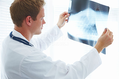 Doctor in the hospital holding x-ray report
