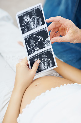 Closeup of a couple with their unborn child\'s sonogram