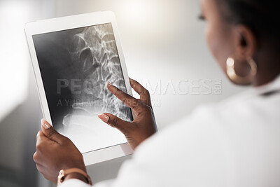 Buy stock photo Shot of a doctor analysing an x ray on the screen of a digital tablet